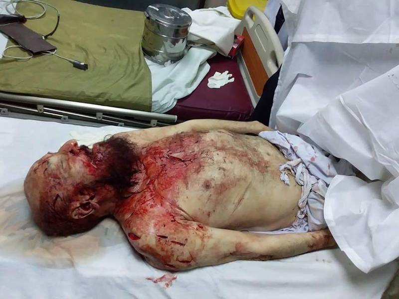 عکس/ پدر معنوی طالبان با چاقو کشته شد (16+)