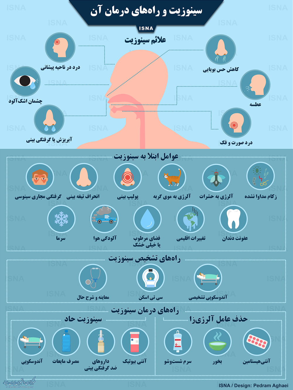 اینفوگرافیک/ سینوزیت و راههای درمان آن