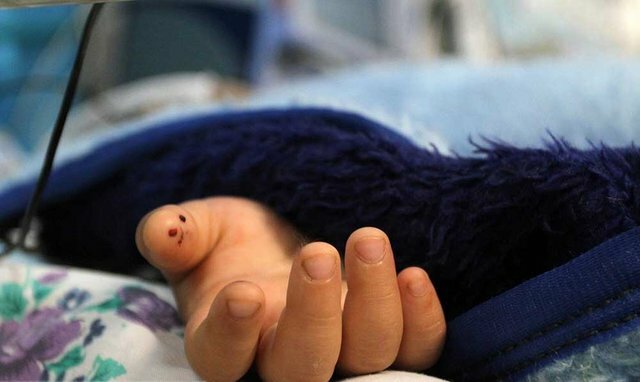 سگ‌های ولگرد کودک ۹ ساله را در میبد دریدند