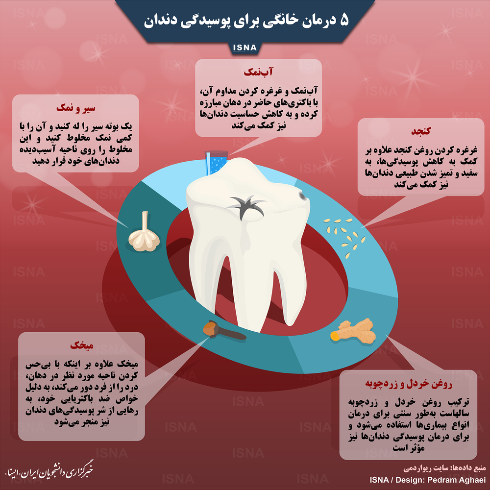 اینفوگرافیک/ ۵ درمان خانگی برای پوسیدگی دندان‌