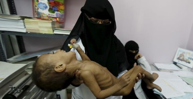 سازمان ملل زنگ خطر را در یمن به صدا درآورد سازمان ملل زنگ خطر را در یمن به صدا درآورد