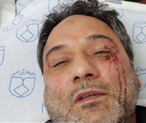 مشت و لگد، تهدید به قتل و فحاشی سزای کادر درمان نیست مشت و لگد، تهدید به قتل و فحاشی سزای کادر درمان نیست