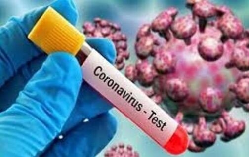 هدفگذاری انجام روزانه ۱۰۰ هزار تست PCR /جزییات انجام تستهای سریع کرونا هدفگذاری انجام روزانه ۱۰۰ هزار تست PCR /جزییات انجام تستهای سریع کرونا