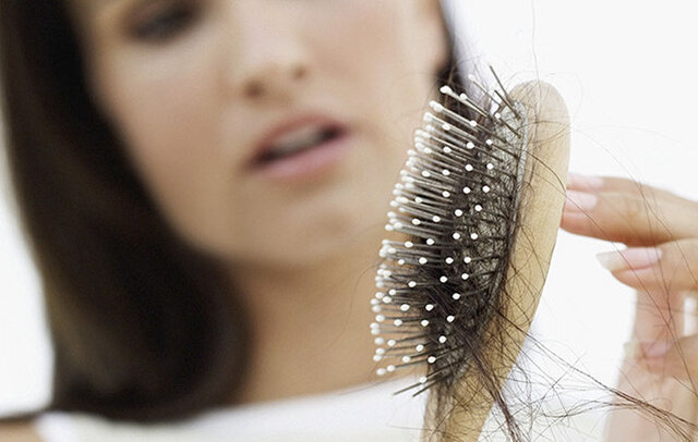 علل ریزش مو در زنان/تاثیر ژنتیک روی ریزش مو