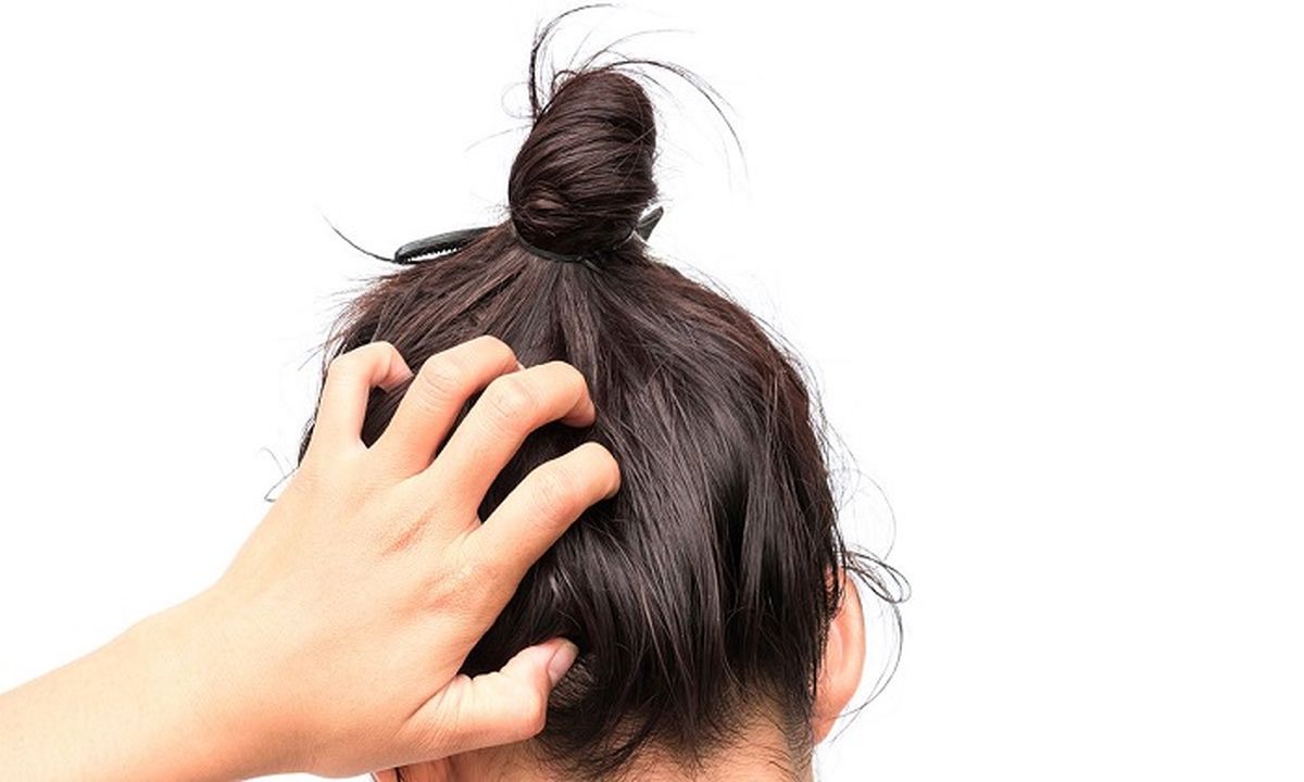 علل ریزش مو در زنان/راه‌های مراقبتی از مو