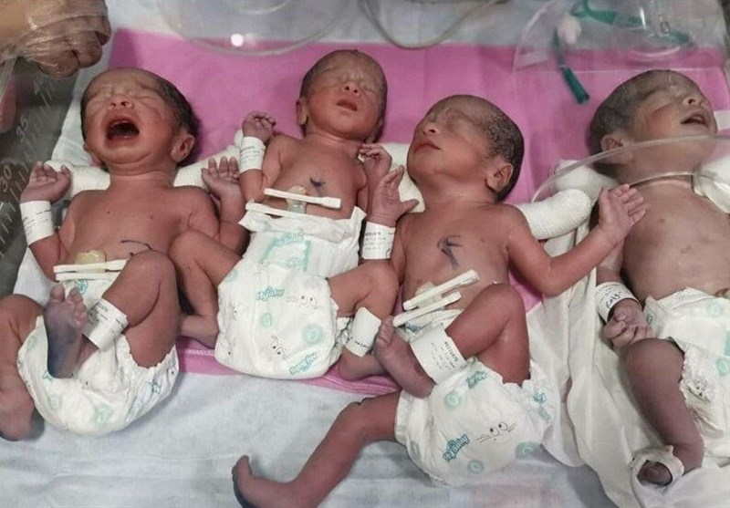 تولد دختران ۴ قلو در کرج؛ مادر ۳۴ ساله تحت مراقبت‌های پزشکی