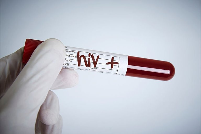 آمار نگران‌کننده ابتلا به HIV در جهان