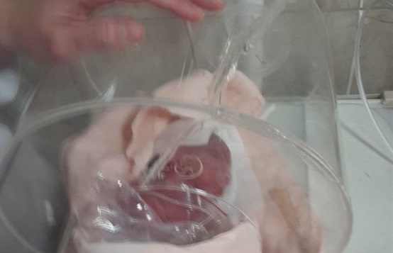 ماجرای عجیب در بیمارستان شهریار؛ انتقال نوزاد ‌زنده‌ به سردخانه!