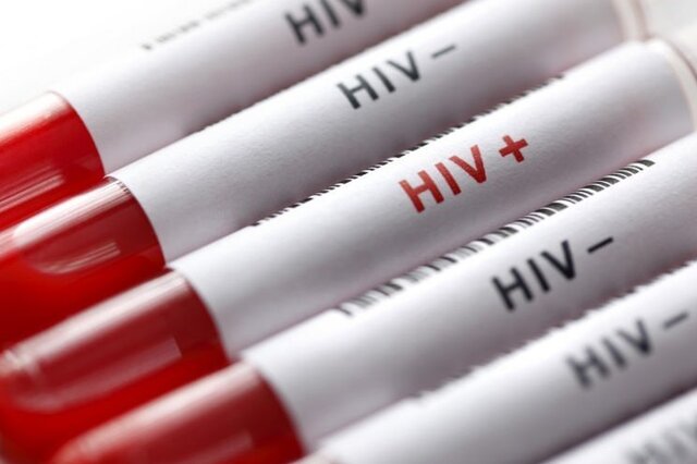 آخرین وضعیت HIV