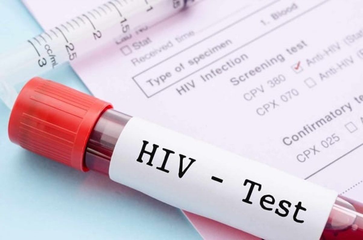 درمان رایگان و محرمانه HIV