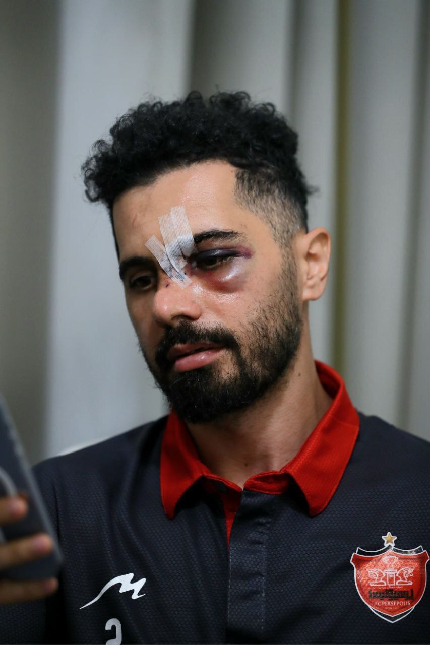 بازگشت امید عالیشاه به تهران
