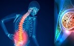 پوکی استخوان از چه‌زمانی شروع می‌شود؟